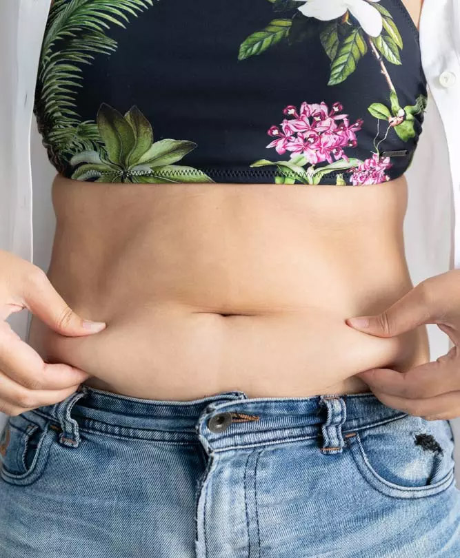 Tummy Tuck London